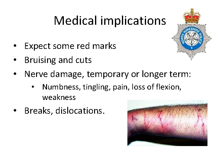 Medical implications • Expect some red marks • Bruising and cuts • Nerve damage,