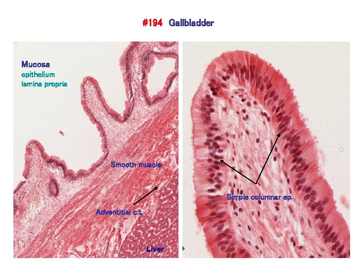 #194 Gallbladder Mucosa epithelium lamina propria Smooth muscle Simple columnar ep. Adventitial c. t.