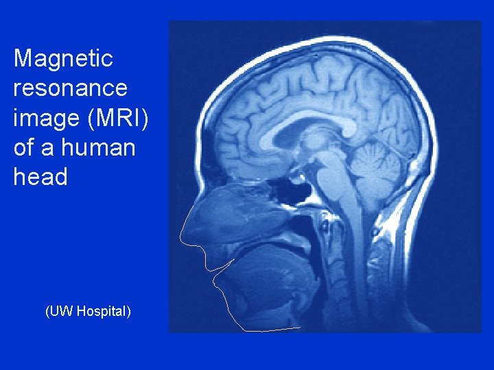 Magnetic resonance image (MRI) of a human head (UW Hospital) 