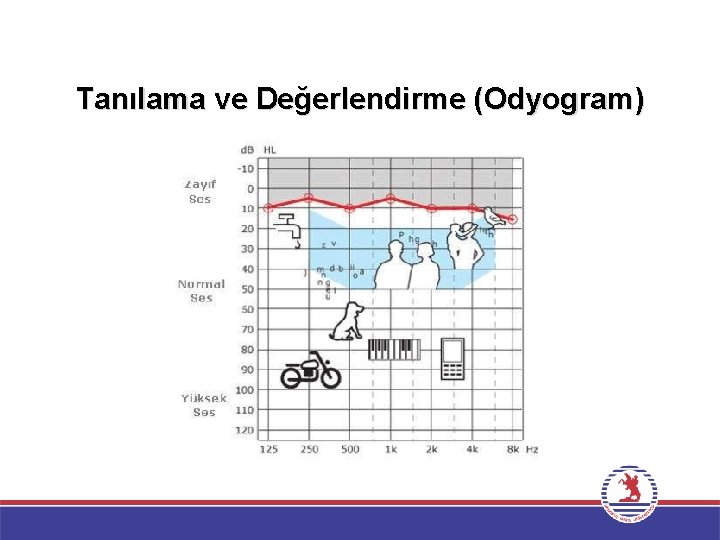 Tanılama ve Değerlendirme (Odyogram) 