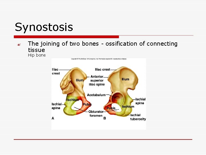 Synostosis ? The joining of two bones - ossification of connecting tissue Hip bone