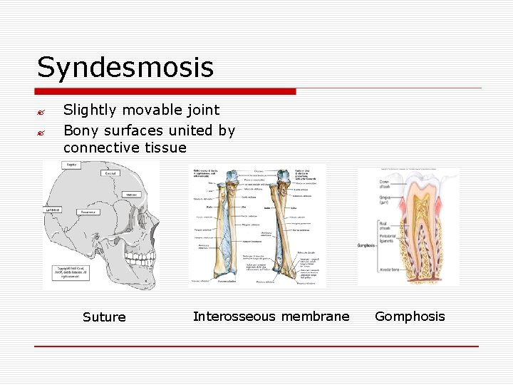 Syndesmosis ? ? Slightly movable joint Bony surfaces united by connective tissue Suture Interosseous