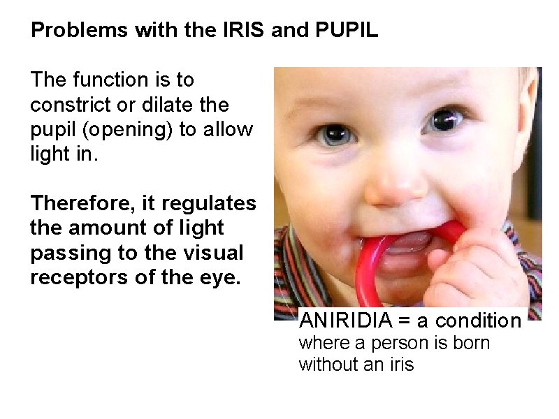 Problems with the IRIS and PUPIL The function is to constrict or dilate the