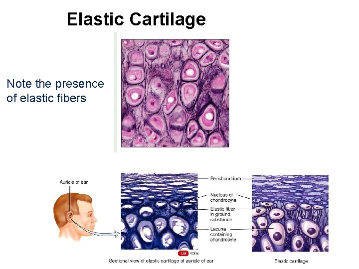 Elastic Cartilage (g) Cartilage: elastic Note the presence of elastic fibers Photomicrograph: Elastic cartilage