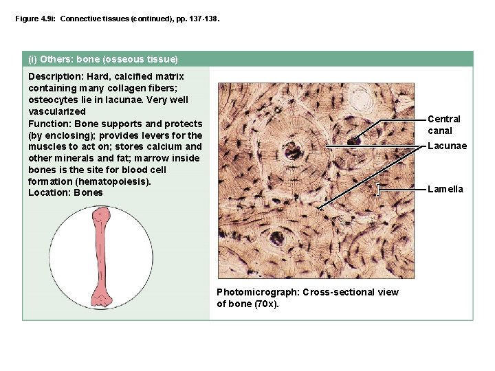 Figure 4. 9 i: Connective tissues (continued), pp. 137 -138. (i) Others: bone (osseous