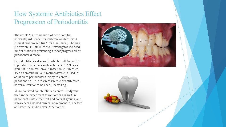 How Systemic Antibiotics Effect Progression of Periodontitis The article “Is progression of periodontitis relevantly