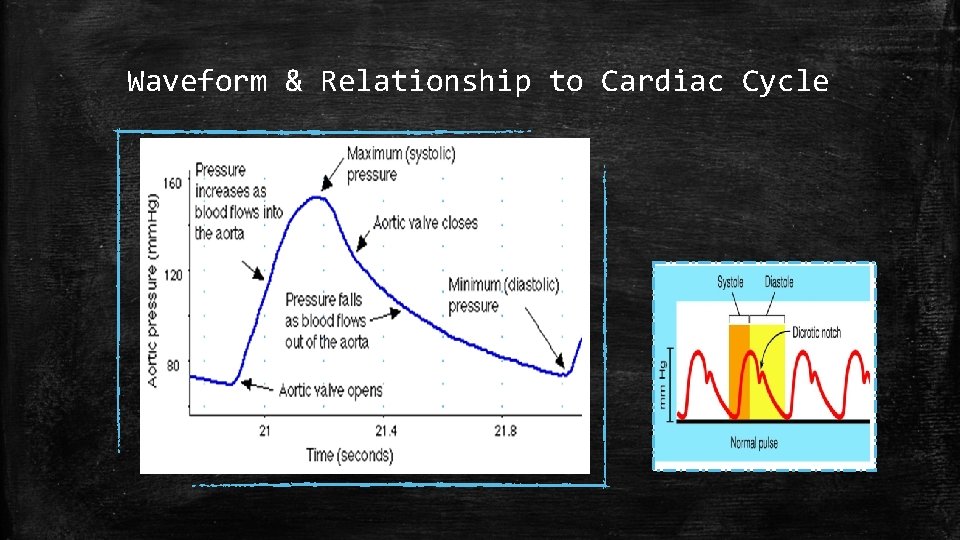 Waveform & Relationship to Cardiac Cycle 