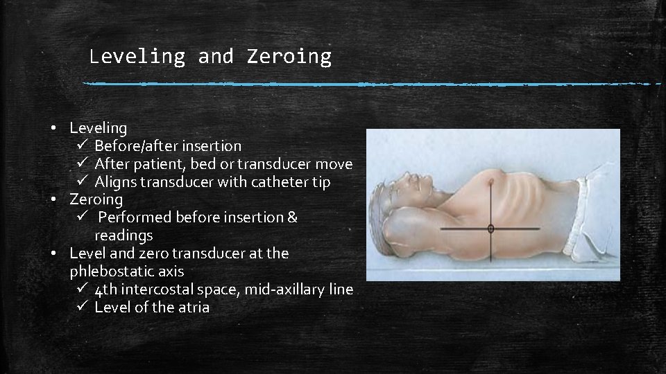 Leveling and Zeroing • Leveling ü Before/after insertion ü After patient, bed or transducer