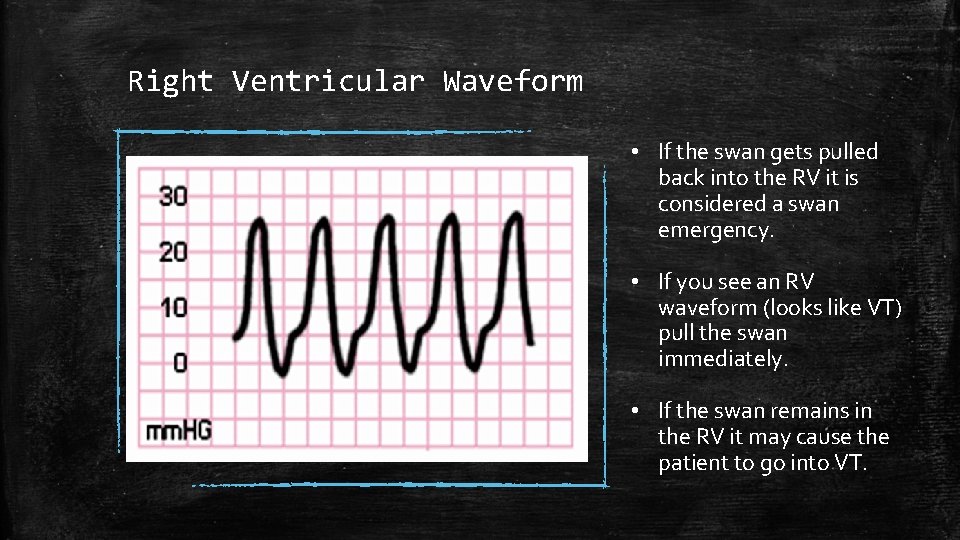 Right Ventricular Waveform • If the swan gets pulled back into the RV it