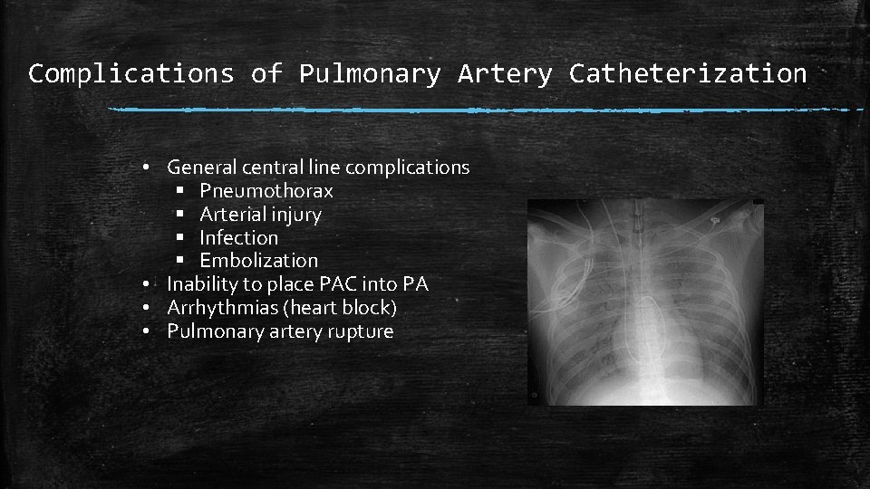 Complications of Pulmonary Artery Catheterization • General central line complications § Pneumothorax § Arterial