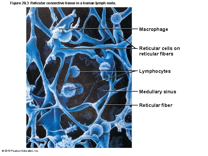 Figure 20. 3 Reticular connective tissue in a human lymph node. Macrophage Reticular cells