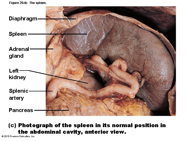 Figure 20. 6 c The spleen. Diaphragm Spleen Adrenal gland Left kidney Splenic artery