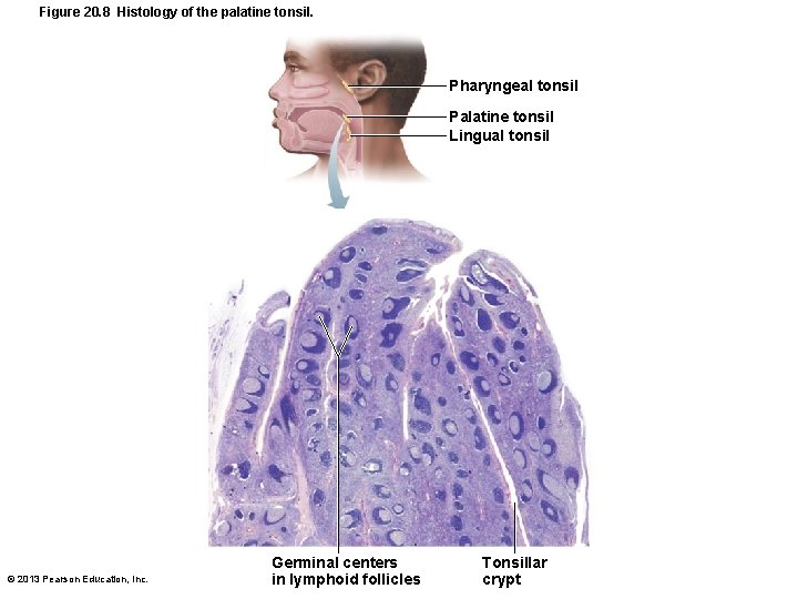 Figure 20. 8 Histology of the palatine tonsil. Pharyngeal tonsil Palatine tonsil Lingual tonsil