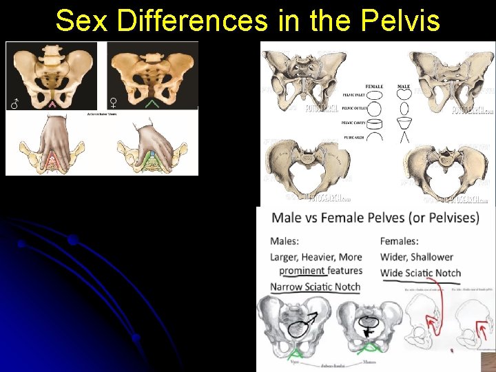Sex Differences in the Pelvis 