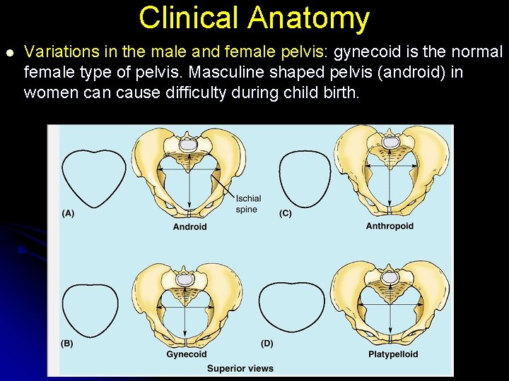 Clinical Anatomy l Variations in the male and female pelvis: gynecoid is the normal