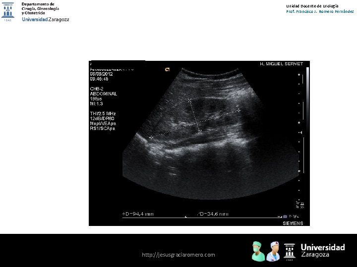 Unidad Docente de Urología Prof. Francisco J. Romero Fernández http: //jesusgraciaromero. com 