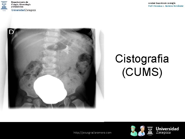 Unidad Docente de Urología Prof. Francisco J. Romero Fernández Cistografia (CUMS) http: //jesusgraciaromero. com