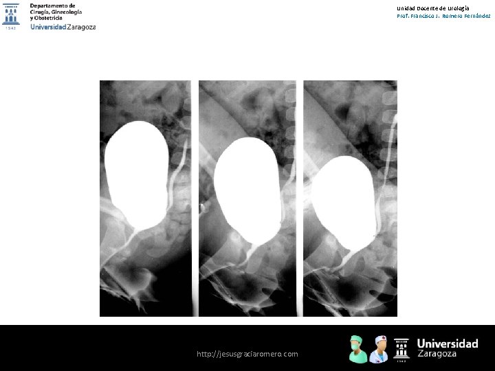 Unidad Docente de Urología Prof. Francisco J. Romero Fernández http: //jesusgraciaromero. com 