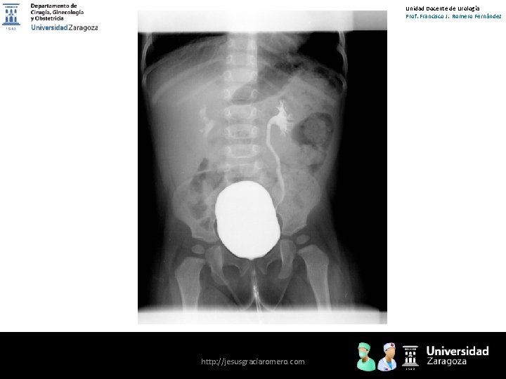 Unidad Docente de Urología Prof. Francisco J. Romero Fernández http: //jesusgraciaromero. com 