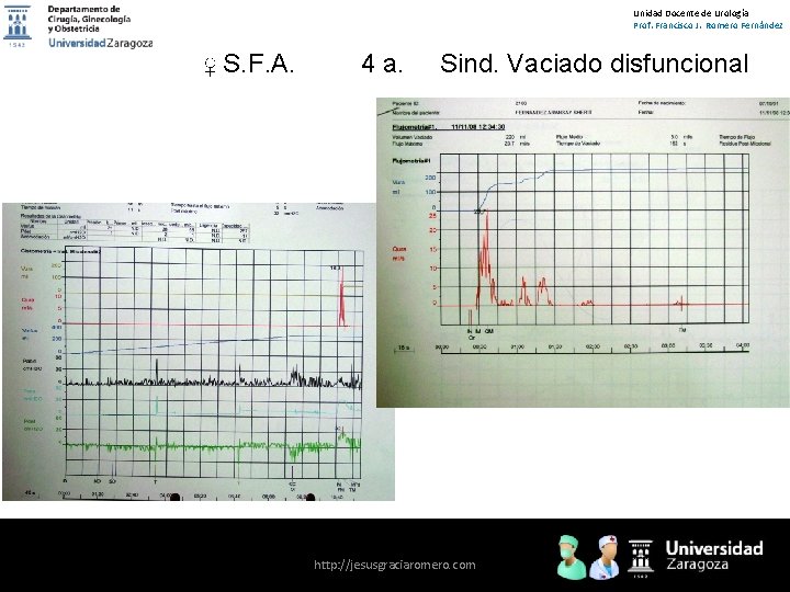 Unidad Docente de Urología Prof. Francisco J. Romero Fernández ♀ S. F. A. 4