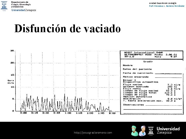 Unidad Docente de Urología Prof. Francisco J. Romero Fernández Disfunción de vaciado http: //jesusgraciaromero.