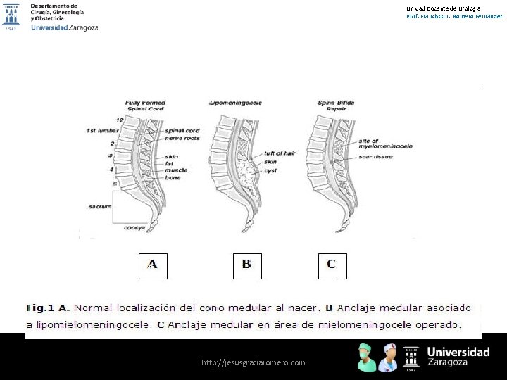 Unidad Docente de Urología Prof. Francisco J. Romero Fernández http: //jesusgraciaromero. com 