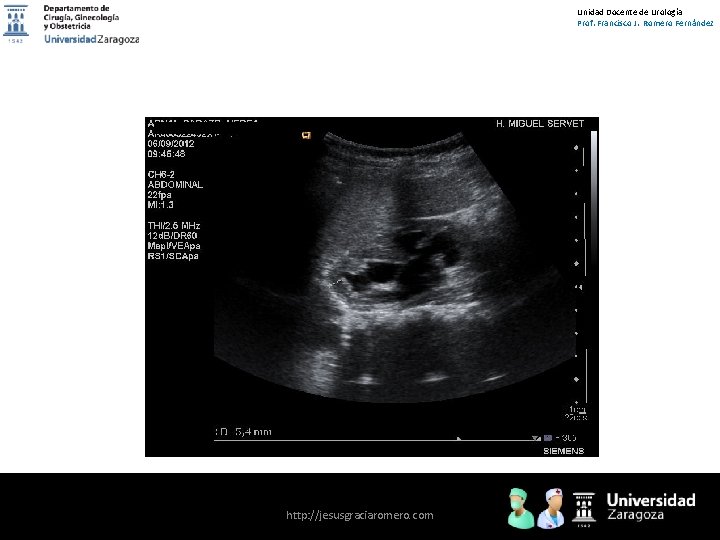Unidad Docente de Urología Prof. Francisco J. Romero Fernández http: //jesusgraciaromero. com 