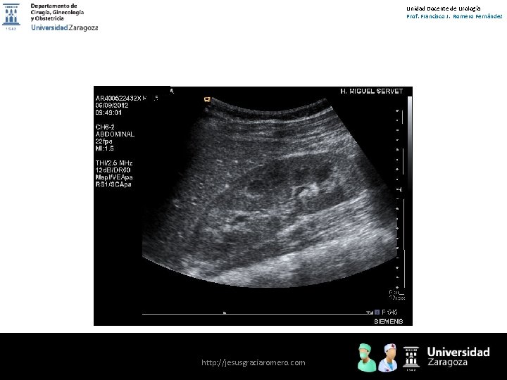 Unidad Docente de Urología Prof. Francisco J. Romero Fernández http: //jesusgraciaromero. com 