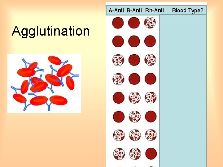 A-Anti B-Anti Rh-Anti Agglutination Blood Type? 