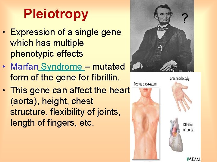 Pleiotropy • Expression of a single gene which has multiple phenotypic effects • Marfan