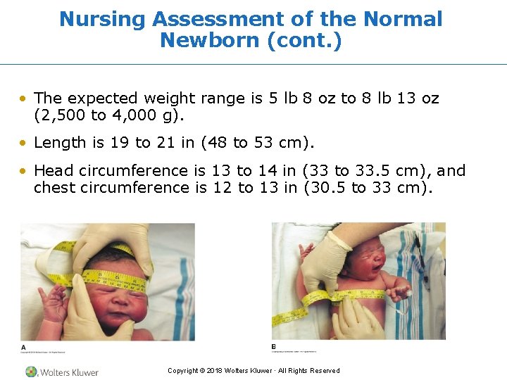 Nursing Assessment of the Normal Newborn (cont. ) • The expected weight range is