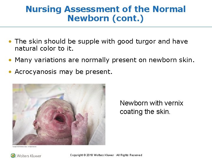 Nursing Assessment of the Normal Newborn (cont. ) • The skin should be supple