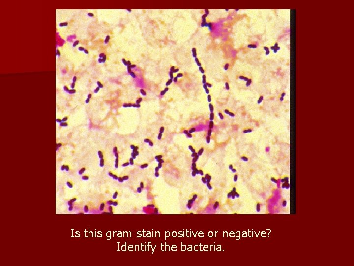 Is this gram stain positive or negative? Identify the bacteria. 