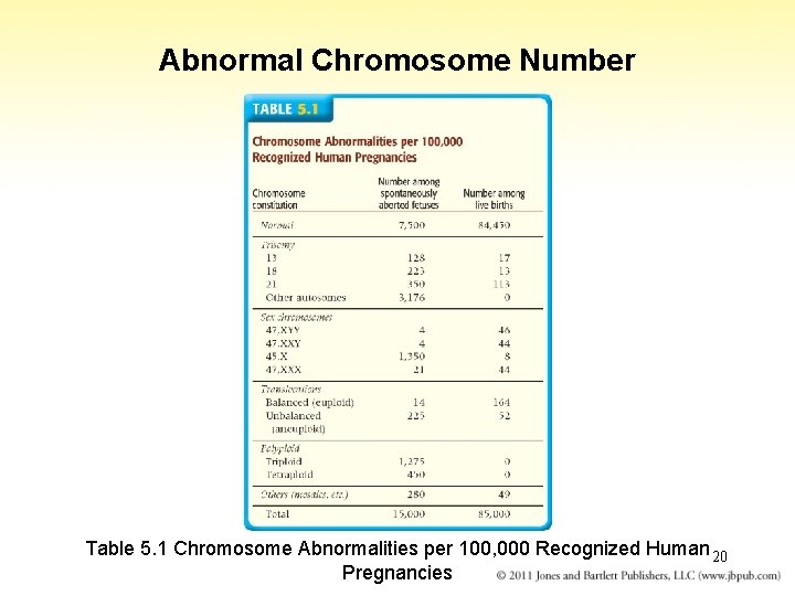Abnormal Chromosome Number Table 5. 1 Chromosome Abnormalities per 100, 000 Recognized Human 20