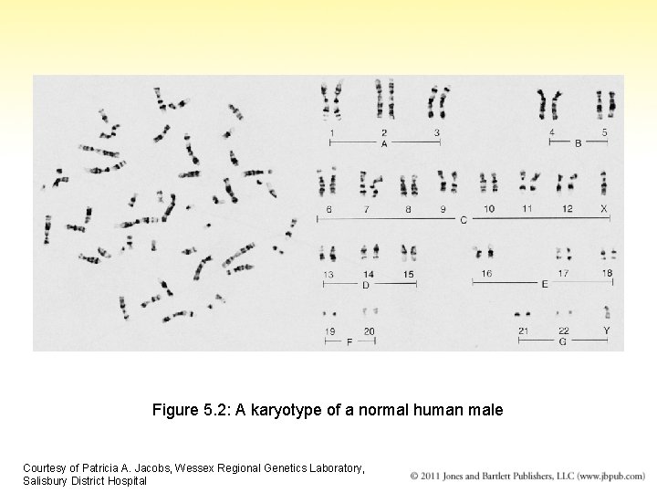 Figure 5. 2: A karyotype of a normal human male Courtesy of Patricia A.