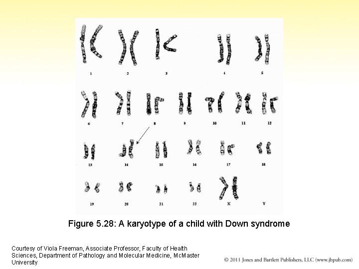 Figure 5. 28: A karyotype of a child with Down syndrome Courtesy of Viola