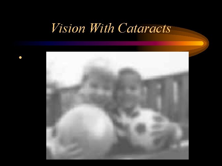 Vision With Cataracts • 