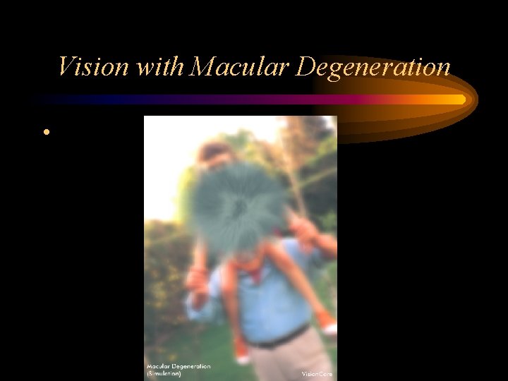 Vision with Macular Degeneration • 