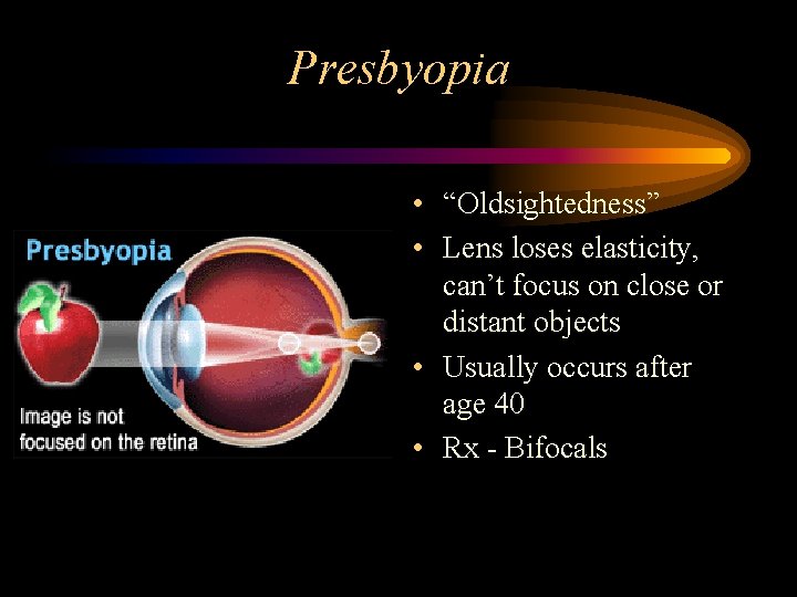 Presbyopia • “Oldsightedness” • Lens loses elasticity, can’t focus on close or distant objects