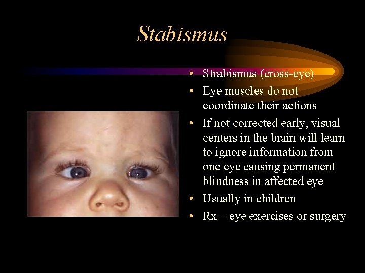 Stabismus • Strabismus (cross-eye) • Eye muscles do not coordinate their actions • If