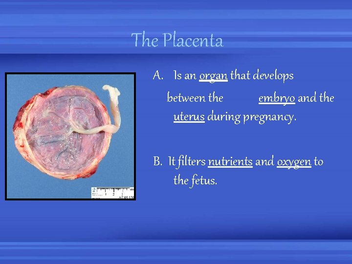 The Placenta A. Is an organ that develops between the embryo and the uterus