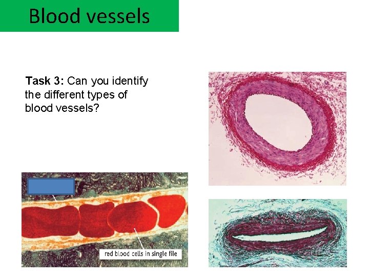 Blood vessels Task 3: Can you identify the different types of blood vessels? 