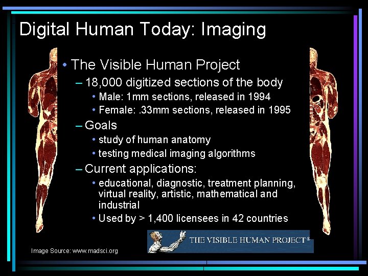 Digital Human Today: Imaging • The Visible Human Project – 18, 000 digitized sections