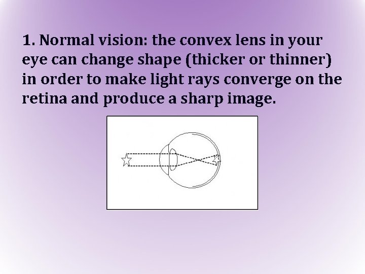 1. Normal vision: the convex lens in your eye can change shape (thicker or