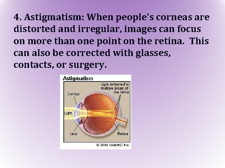 4. Astigmatism: When people’s corneas are distorted and irregular, images can focus on more