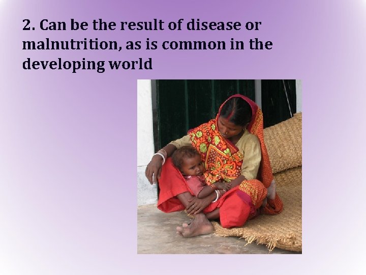 2. Can be the result of disease or malnutrition, as is common in the