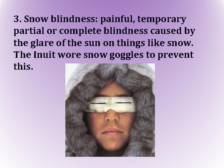 3. Snow blindness: painful, temporary partial or complete blindness caused by the glare of