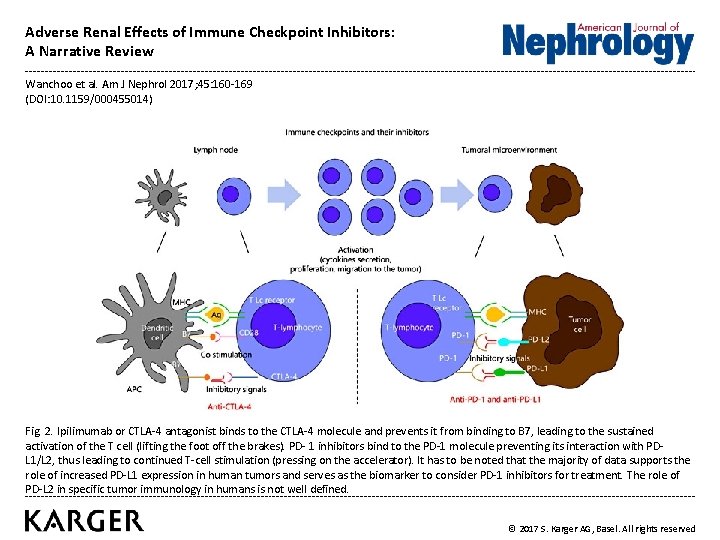Adverse Renal Effects of Immune Checkpoint Inhibitors A