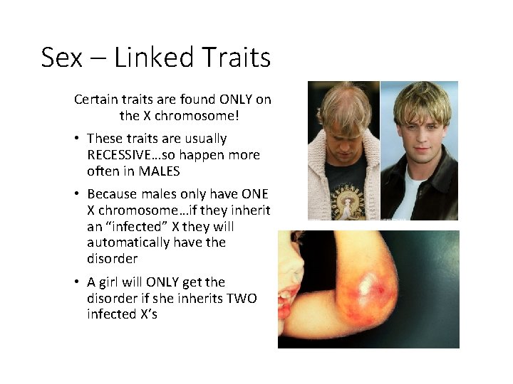 Sex – Linked Traits Certain traits are found ONLY on the X chromosome! •