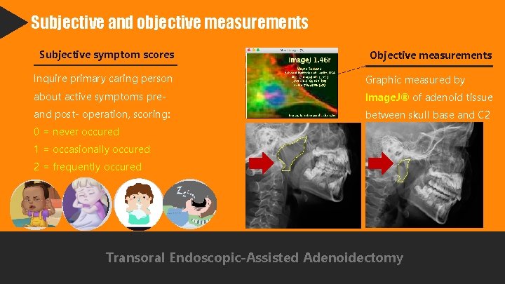 Subjective and objective measurements Subjective symptom scores Objective measurements Inquire primary caring person Graphic